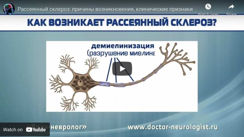 chronic arthritis video in Russian for CDPAP resource page